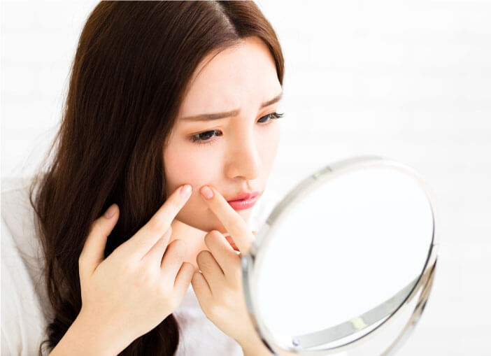 Adult Acne: A Problem Beyond Your Teens: What Is Adult Acne